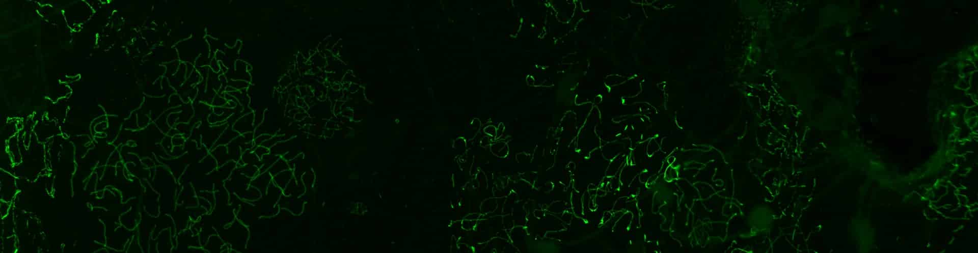 Download document: The Re-scan Confocal Microscope (RCM) minimizes motion-blur when imaging fast germination proteins dynamics