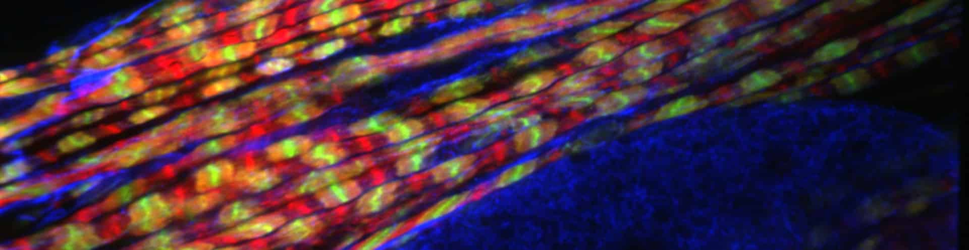 The Re-scan Confocal Microscope (RCM) minimizes motion-blur when imaging fast germination proteins dynamics