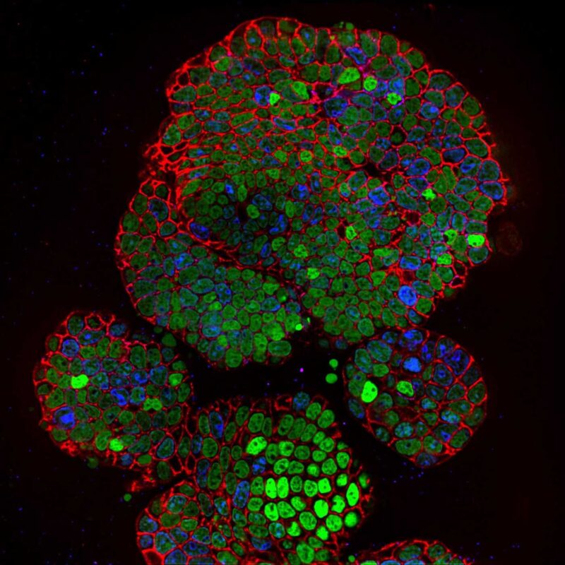 Intestinal organoid imaged