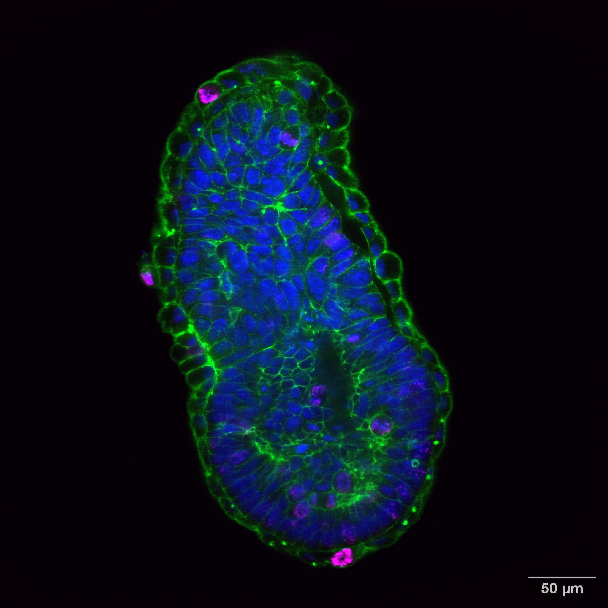 What types of REscan confocal microscopes are there?